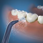 Handheld Cordless Precision Low-Flow Tip - Image 3