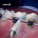 Orthodontic Tip - Image 3
