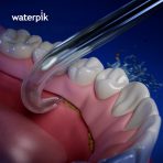 Implant Denture Tip - Image 3